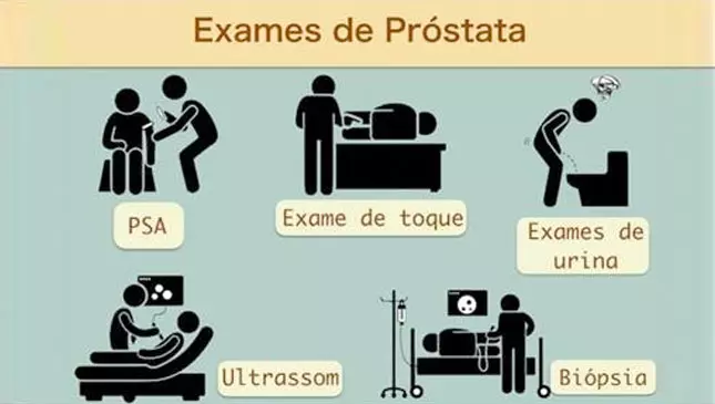 exame da próstata para embolização