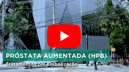 vídeo sobre embolização