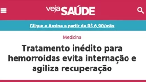 embolização das hemorroidas