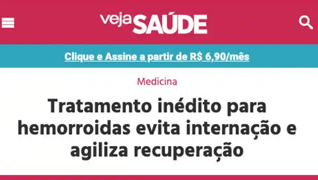 embolização das hemorroidas