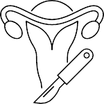 procedimento de histerectomia