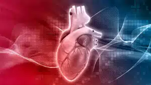 malformação arteriovenosa (MAV)