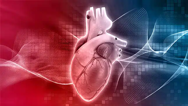 malformação arteriovenosa (MAV)