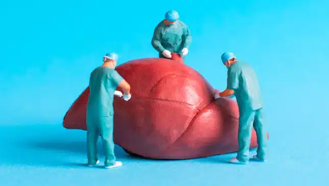 embolização da veia porta