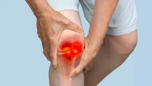 embolização para artrose