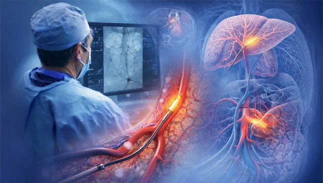 Preparo pré-procedimentos da radiologia intervencionista