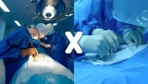 cirurgia tradicional x Radiologia Intervencionista