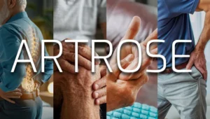 tratamento de artrose